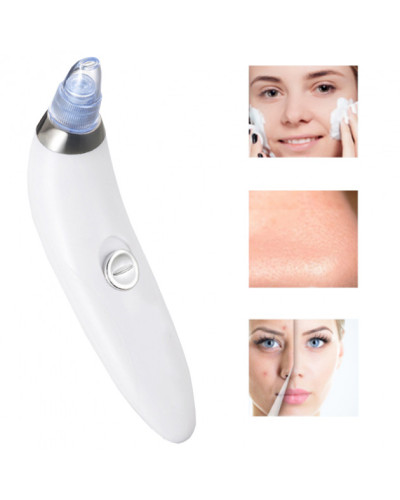 Вакуумний очисник пор для обличчя Derma Suction білий 174771
