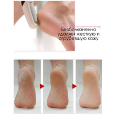 Електрична Пемза Для Ніг Wanhengda Pedi Electronic 204272