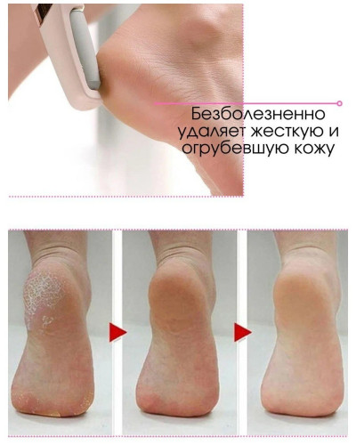 Електрична Пемза Для Ніг Wanhengda Pedi Electronic 204272