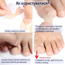 Набір пластирів Elastic Toenail Correction Sticker для корекції та усунення врослих нігтів 50 шт 207402